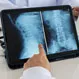 How Can I Prevent Degenerative Disc Disease From Getting Worse?